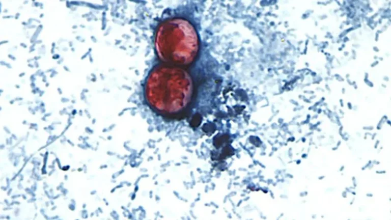 Diarrhea-causing parasite that can contaminate raw produce causing misery across several states | CNN